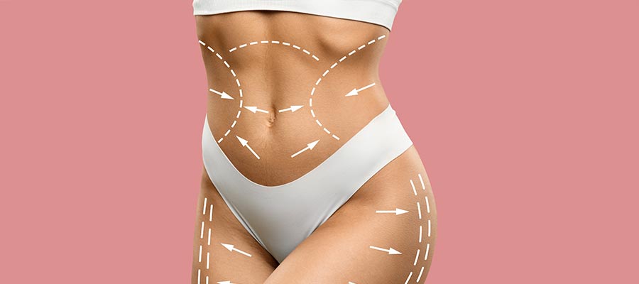 What Is Perfect Shape Neo Body Sculpting and How Does It Work? | Memorial Health Urgent Care Near Me in Katy, TX What Is Perfect Shape Neo Body Sculpting and How Does It Work? | Memorial Health Urgent Care Near Me in Katy, TX