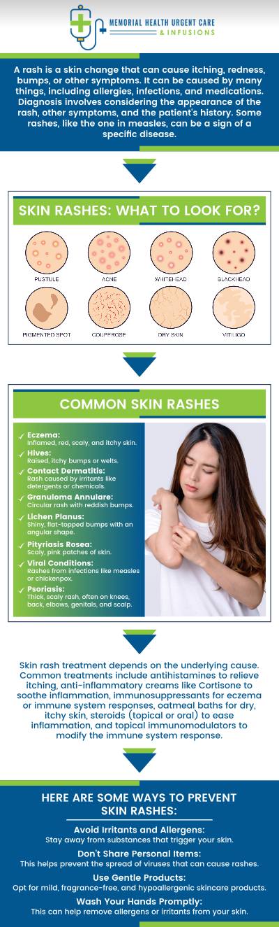 Common questions asked by patients: What would cause a sudden rash? How do I identify the rash that I have? What are the 4 types of rash? What does an allergy rash look like? For more information, please contact us or book an appointment online. We are conveniently located at 26077 Nelson Way, Unit 104, Katy, TX 77494. We serve patients from Brookshire TX, Park Row TX, Cinco Ranch TX, Houston TX, Cypress TX, and surrounding areas.