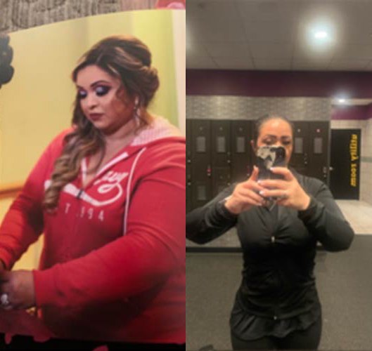 Before and After Images of Patients at Memorial Health Urgent Care and Infusions in Katy, TX Before and After Images of Patients at Memorial Health Urgent Care and Infusions in Katy, TX