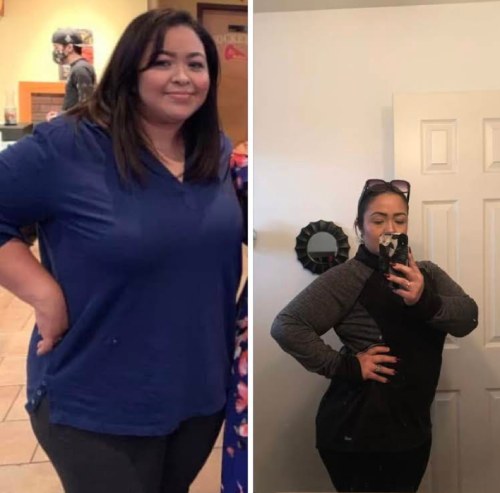 Before and After Images of Patients at Memorial Health Urgent Care and Infusions in Katy, TX Before and After Images of Patients at Memorial Health Urgent Care and Infusions in Katy, TX